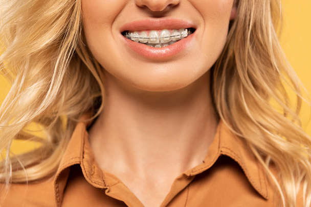 Sarı diş teli takmış gülümseyen kadın görüntüsü. - Fotoğraf, Görsel