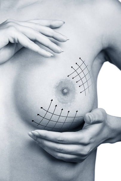 Corrección de senos con ayuda de cirugía plástica
. - Foto, Imagen