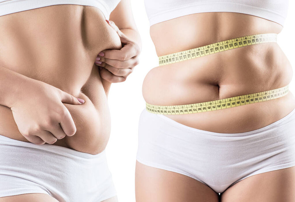 Collage de mujer gorda con pliegues abdominales
. - Foto, Imagen