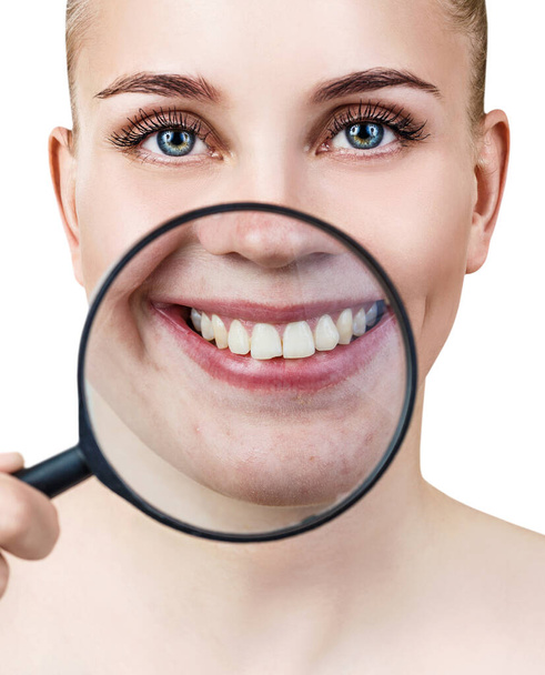 Woman with magnifying glass present teeth before whitening. - Zdjęcie, obraz