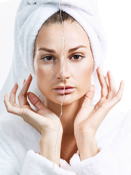 Mujer con acné antes y después de los procedimientos de spa
. - Foto, imagen