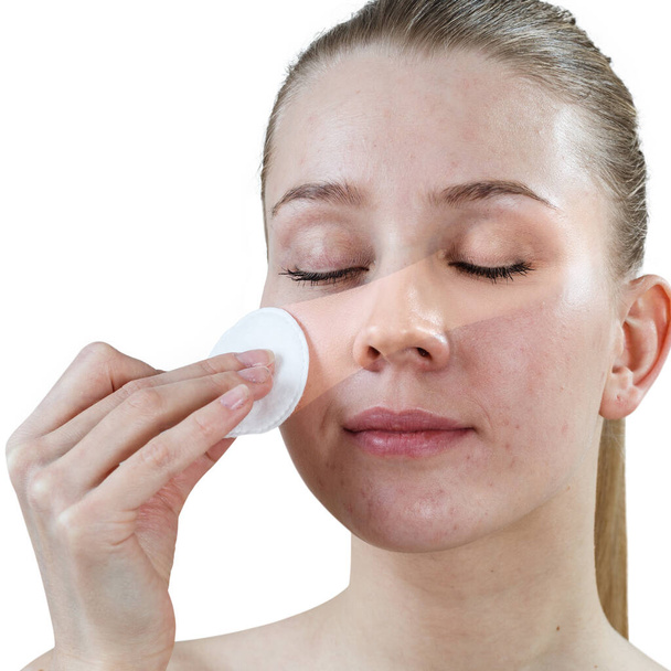 Kobieta czyszczenia twarzy przez bawełniany dysk. Koncepcja pielęgnacji skóry. - Zdjęcie, obraz