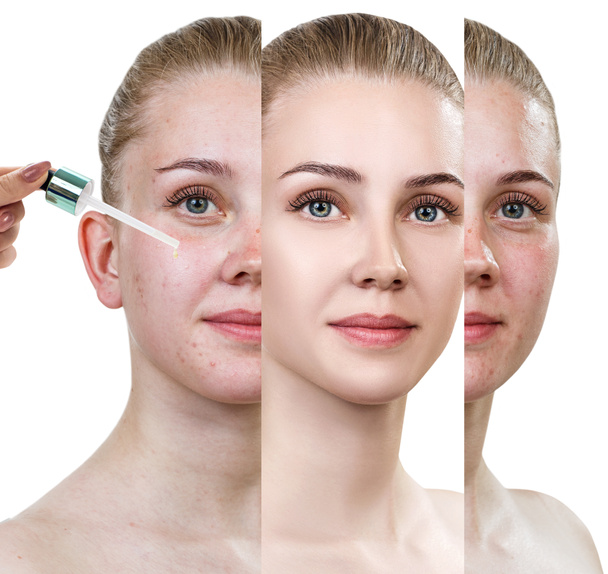 Cosmetics oil applying on face of young woman. - Photo, Image
