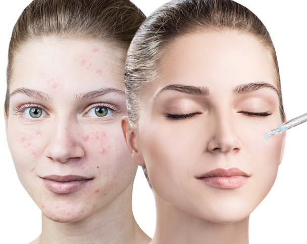 Cosmetics oil applying on face of young woman. - Photo, Image
