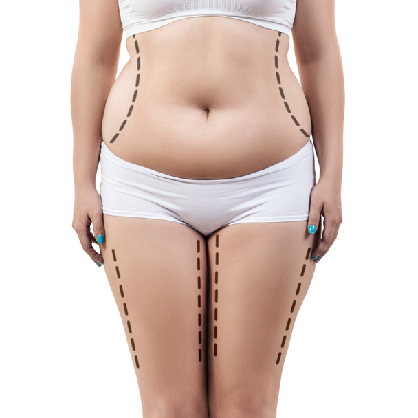 Kövér nő pontozott vonalakkal a testén.. - Fotó, kép