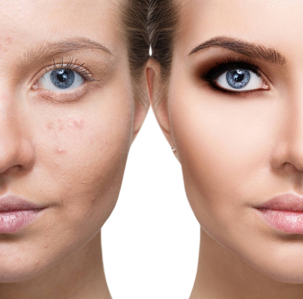 Young woman before and after treatment and bright makeup. - Foto, Imagen