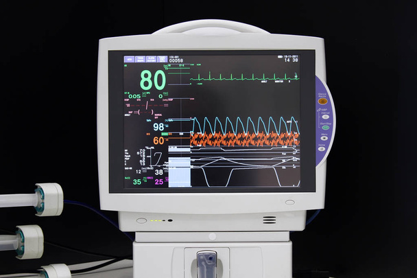 Detalhe do monitor de ECG no hospital
 - Foto, Imagem