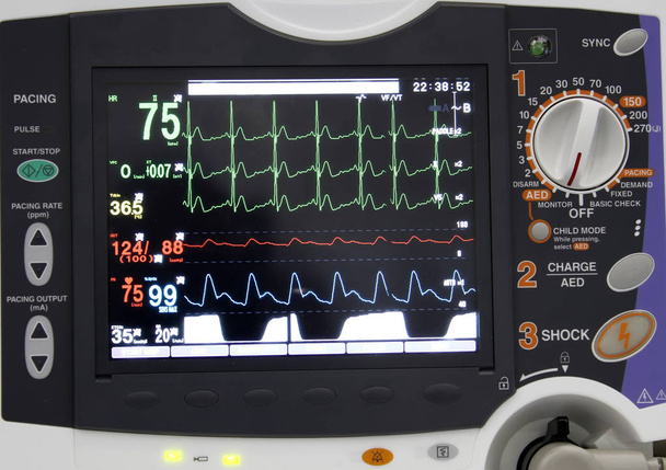 Detalhe do monitor de ECG no hospital
 - Foto, Imagem