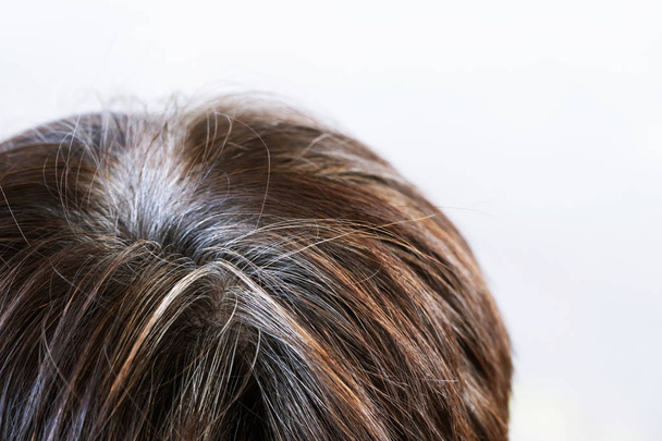 Vista posteriore dei giovani capelli grigi prematuri, mostrando radici di capelli neri hoary sul cambiamento di testa al vecchio anziano
. - Foto, immagini