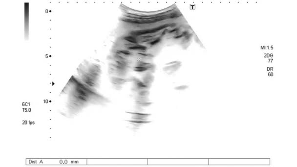 riprese del quarto mese di ecografia in bianco e nero - Filmati, video