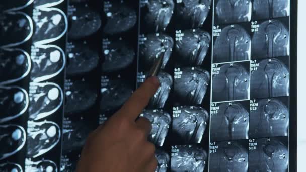Dokter die de MRI-scan onderzoekt - Video