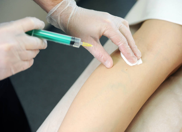 The doctor injects a syringe under the knee. A doctor makes an injection to the varicose veins on a woman s leg, close-up, sclerotherapy, stripping, phlebeurysm, medical. - Φωτογραφία, εικόνα