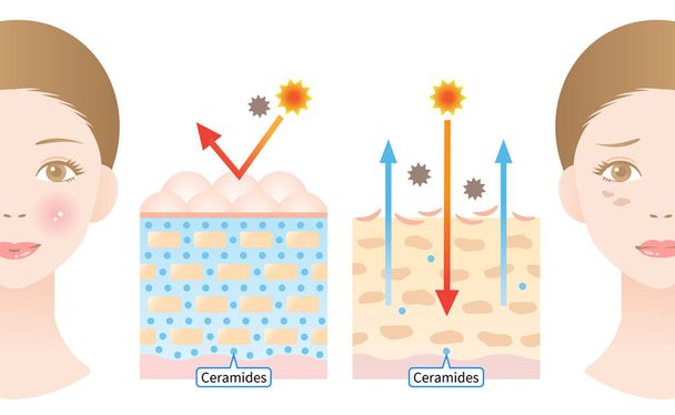 jonge huid bevat ceramiden die een vochtig uiterlijk produceren, verouderde huid heeft minder ceramiden die leiden tot beschadigde huidbarrière. schoonheid en huidverzorging concept - Vector, afbeelding