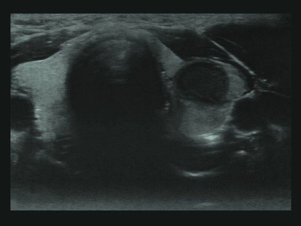 röntgenonderzoek bij mensen met ultrageluid - Foto, afbeelding