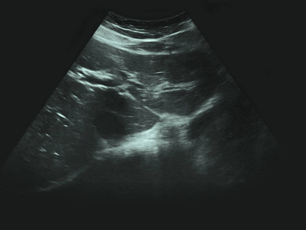 human ultrasound x-ray test medicine - Photo, Image