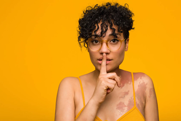 Mujer afroamericana joven con marca de nacimiento de piel manteniendo un secreto o pidiendo silencio
. - Foto, Imagen