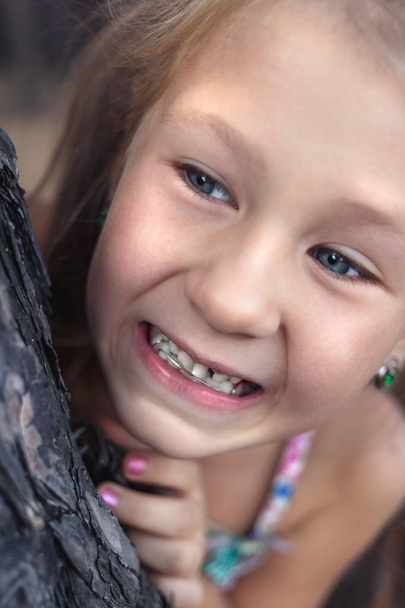 Uma menina perto de um pinheiro mostra um dente de leite oscilante em seu
  - Foto, Imagem