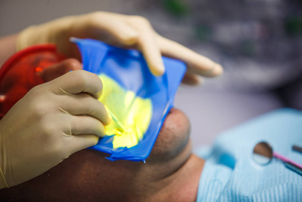 Treatment of the patient in the dentist's office close-up. The process of prosthetics and and the patient's mouth with dental instruments - Photo, Image