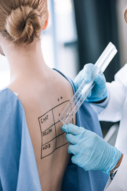 Ausgeschnittene Ansicht eines Allergologen, der Lineal in der Nähe von Frau mit markiertem Rücken hält  - Foto, Bild