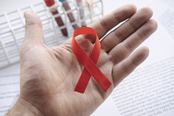 Diagnostiker hält ein rotes Band in der Hand, ein Zeichen für Hiv. - Foto, Bild