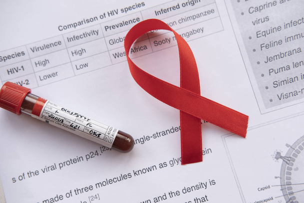 Close up of HIV positive  sample and patient chart. - Photo, image