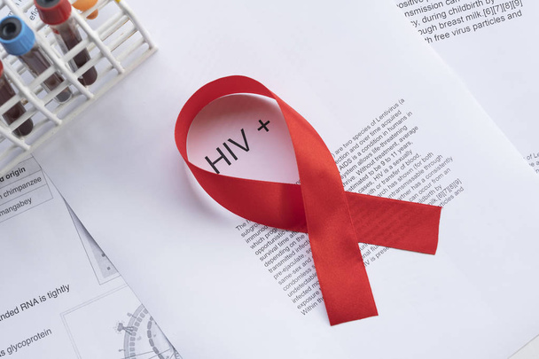 Red ribbon as a sign of HIV in laboratory scenery. Medical life. - Фото, изображение