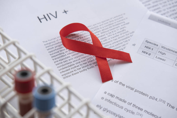Close-up da amostra HIV positiva e prontuário do paciente
. - Foto, Imagem