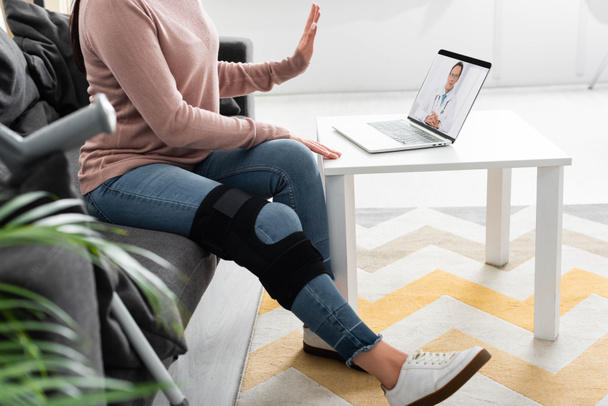 oříznutý pohled na ženu se zlomenou nohou, která má online konzultaci s lékařem na notebooku doma - Fotografie, Obrázek