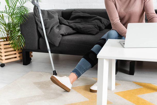 visão cortada da mulher com a perna quebrada ter consulta on-line com o médico no laptop em casa
 - Foto, Imagem
