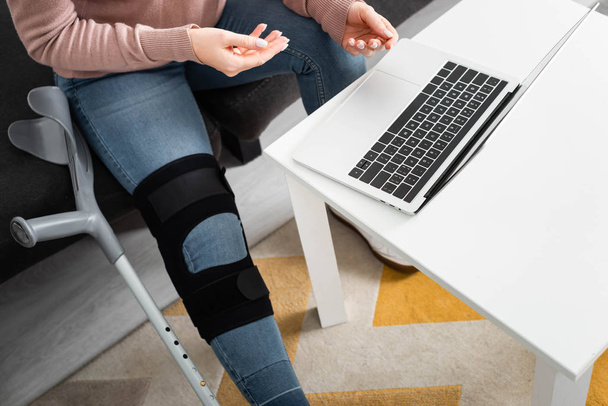 abgeschnittene Ansicht einer Frau mit gebrochenem Bein bei Online-Konsultation mit dem Arzt am Laptop zu Hause - Foto, Bild