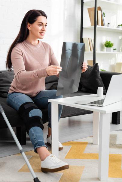mulher mostrando raio-x da perna em consulta on-line com o médico no laptop em casa
 - Foto, Imagem