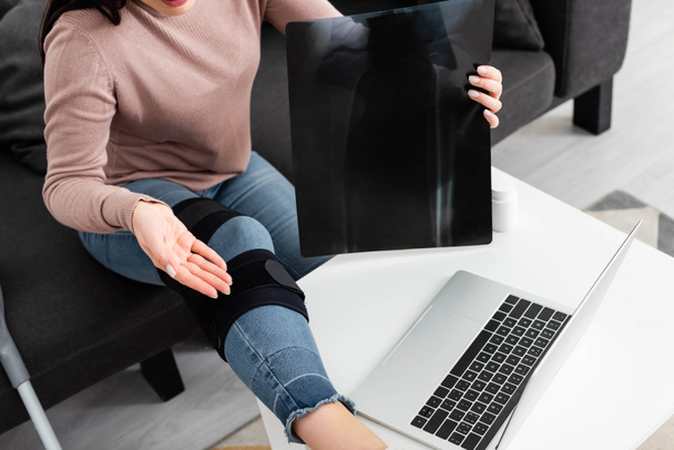 Ausgeschnittene Ansicht der Frau zeigt Röntgenbild des Beines auf Online-Konsultation mit Arzt auf Laptop  - Foto, Bild