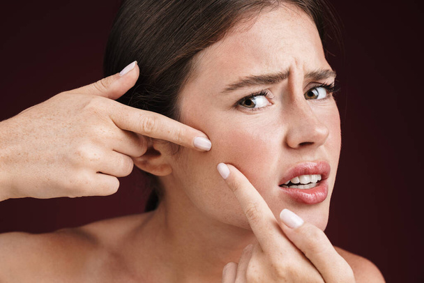 Image of teenage shirtless woman squeezing out pimples - Photo, Image