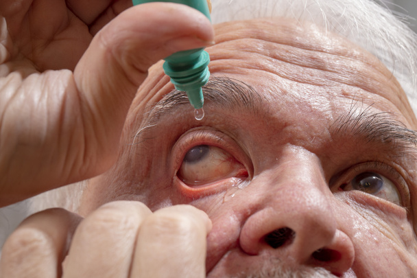Ηλικιωμένος θάβει φάρμακα στα μάτια του - Φωτογραφία, εικόνα