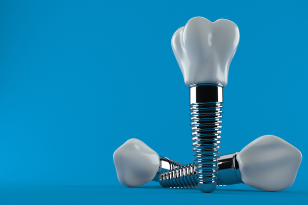 Implante dental
 - Foto, imagen