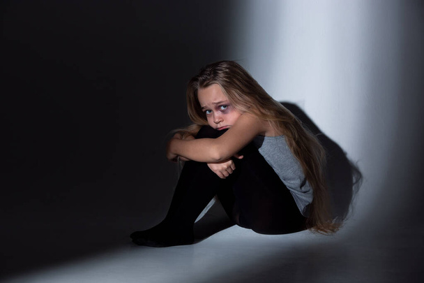 Sad and frightened little girl with bloodshot and bruised eyes sitting scared - Foto, Imagem