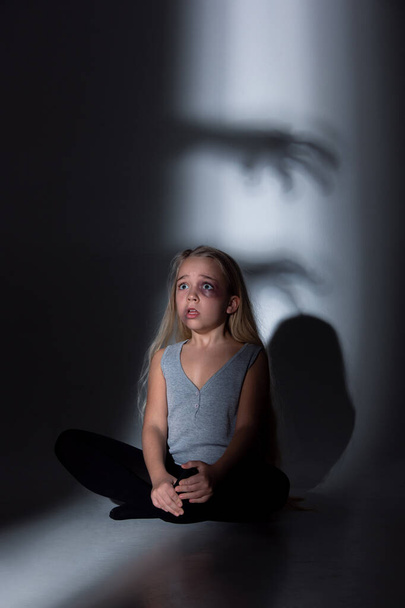 Sad and frightened little girl with bloodshot and bruised eyes sitting scared - 写真・画像