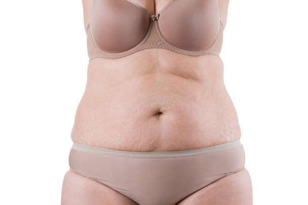 Tummy tuck, flabby skin on a fat belly, plastic surgery concept - Foto, immagini