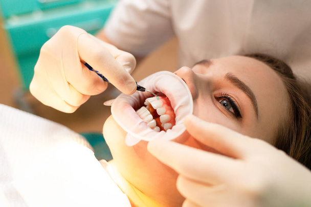 Paciente com retrator de bochechas na cadeira dentária durante o procedimento
 - Foto, Imagem