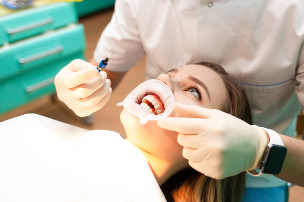 Yanak retraktörlü kadın portresi prosedür sırasında dişçi koltuğunda yatıyor. - Fotoğraf, Görsel