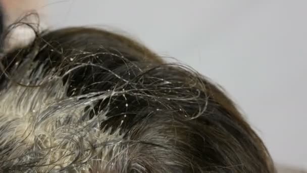 Las raíces grises de una mujer de mediana edad que se tiñe el cabello con un cepillo especial. Cabello oscuro y raíces blancas de una cabeza de mujer sobre un fondo blanco. Cuidado del cabello en el salón vista de cerca
. - Imágenes, Vídeo