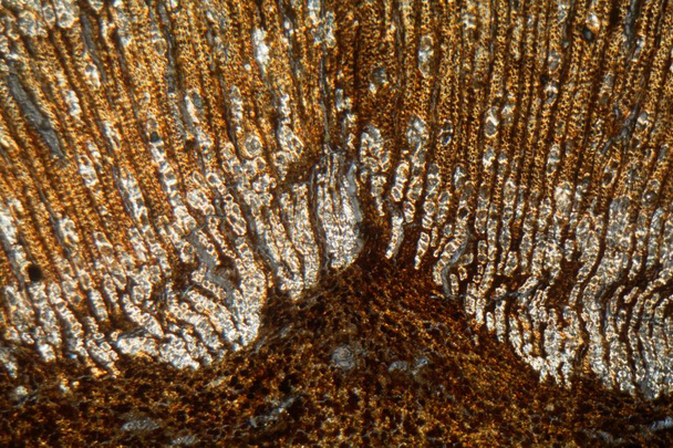 Holz und Rindenzellen eines sudanesischen Weihrauchbaums, Boswellia papyrifera, unter dem Mikroskop.  - Foto, Bild
