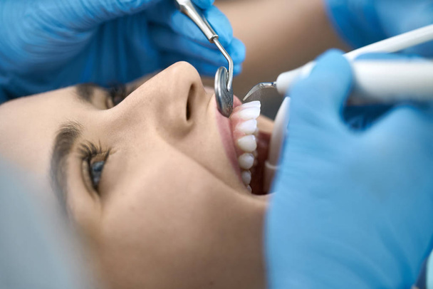 Pretty womans teeth treatment in dental clinic - Фото, зображення