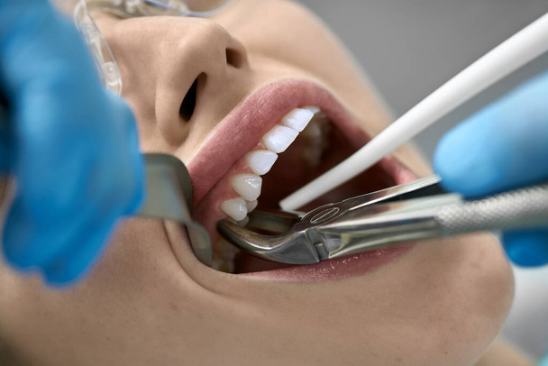 Pretty womans teeth treatment in dental clinic - Foto, imagen