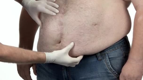 Lääkäri tutkii lihavan miehen vatsaa.
. - Materiaali, video