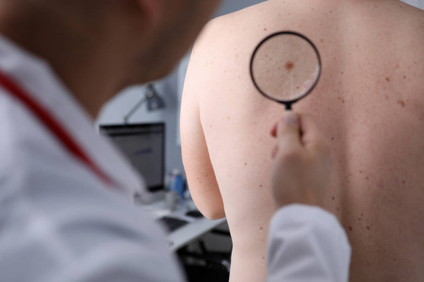 Männliche Ärzte betrachten Vergrößerungsglas auf der Haut des Patienten - Foto, Bild