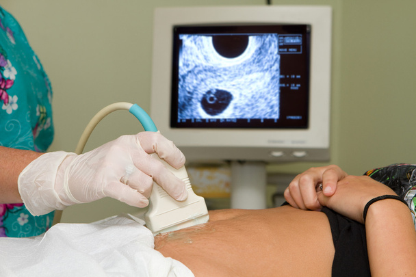 echografie van de zwangerschap - Foto, afbeelding