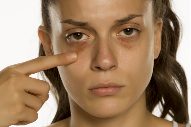 junge Frau berührt ihre niedrigen Augenlider auf gelbem Hintergrund - Foto, Bild