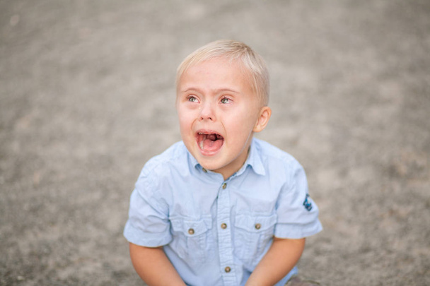 Het dagelijks leven van een kind met een handicap. Een jongen met Down Syndroom. Chromosomale en genetische stoornis bij de baby. - Foto, afbeelding
