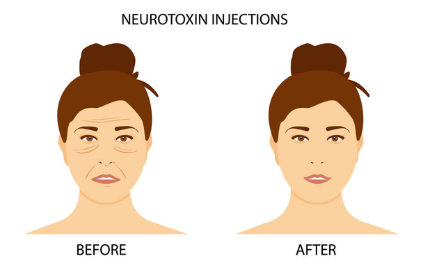 Mature woman face before and after - Vector, Image